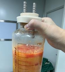 孟津水动力吸脂手术要做多久？